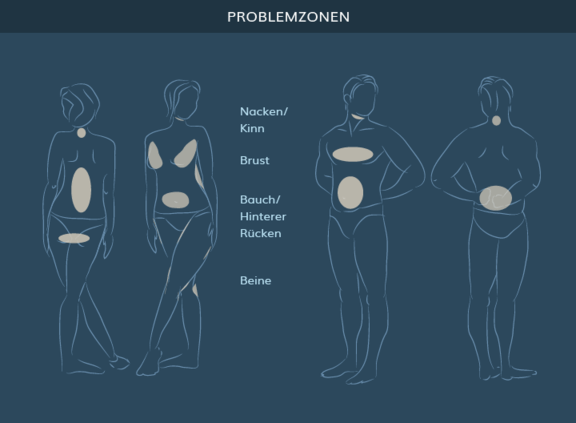 Graphik Fettabsaugung, info Ästhetik